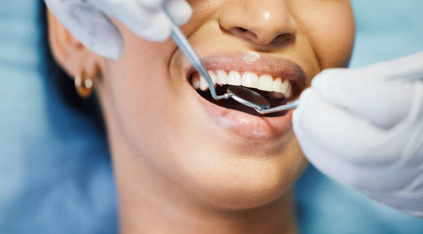 Best Emergency Gum Treatment in Thonotosassa, FL